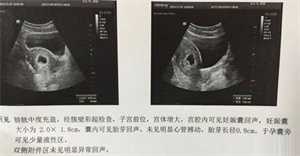 天津单身的女性做试管婴儿去哪个医院好？
